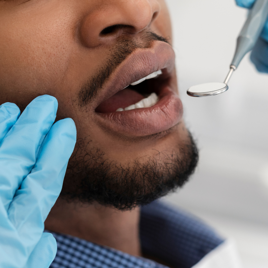 A close-up of a person with a beard opening their mouth during a dental examination. A gloved hand holds their jaw while another hand holds a dental mirror near their teeth.